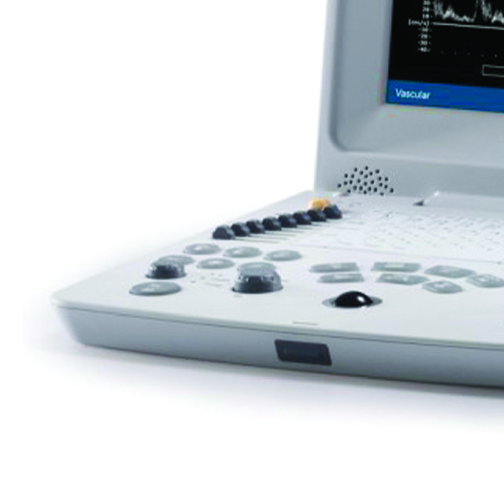 Patient monitors - Dimed Dus 60 Portable Eco-doppler Ultrasound System