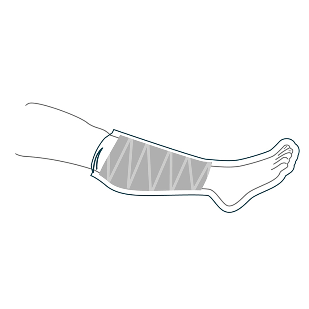 Foot braces - Intermed Aquaprotect Half-leg Waterproof Bath And Shower Protector